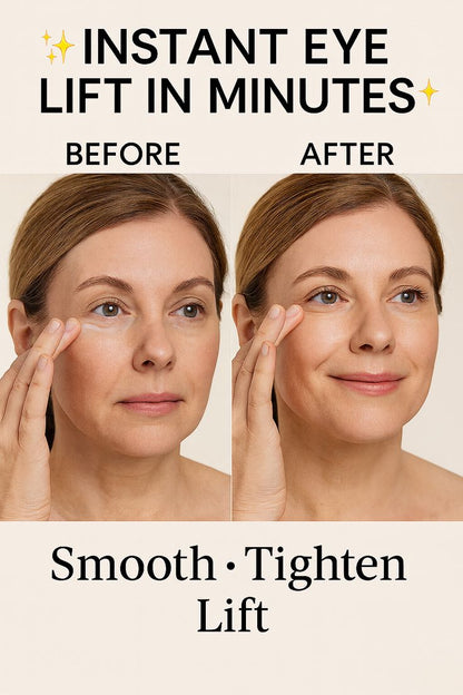 Lid Lifting Treatment – Smooth & Tighten Droopy Eyelids